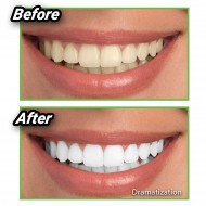 Miracle Teeth - cărbune pentru albirea dinților